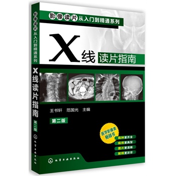 ӰxƬT(mn)ͨϵ--XxƬָ()